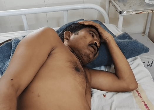 Auraiya News: पिता-पुत्र में चले लाठी-डंडे, महिला समेत चार घायल